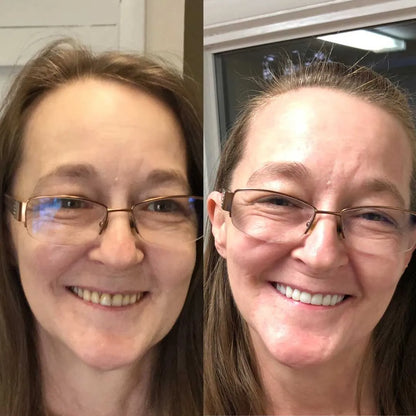 DentSecure™ | Få et stærkt, sikkert og bekymringsfrit smil hele dagen