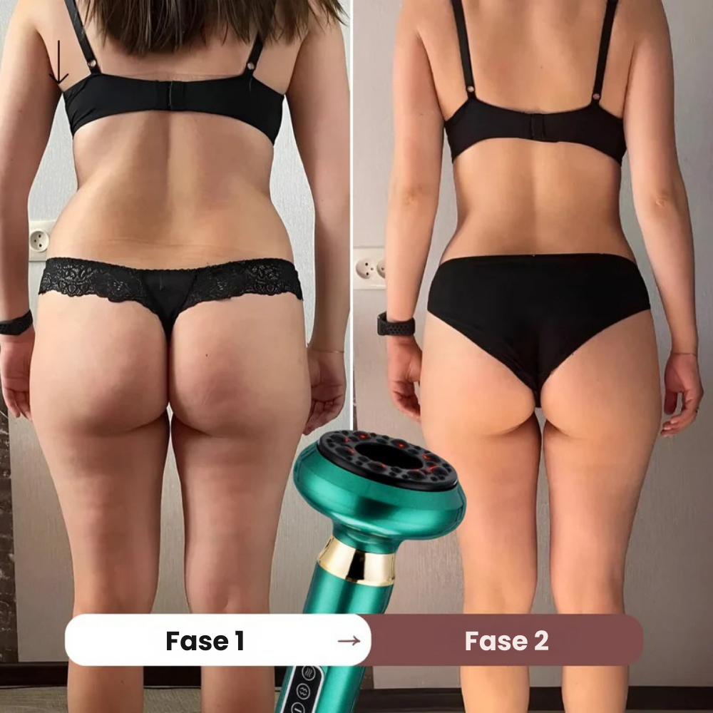 CelluSculpt Pro™ | 4-i-1 -massageapparat med cupping, infrarød og varme – reducerer cellulite og strækmærker synligt