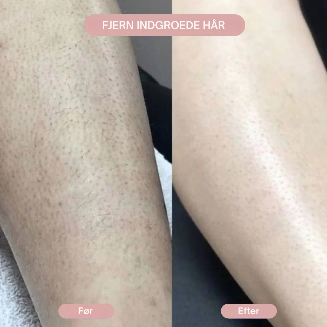 SilkPro™ - 2-i-1 Barbermaskine til Kvinder