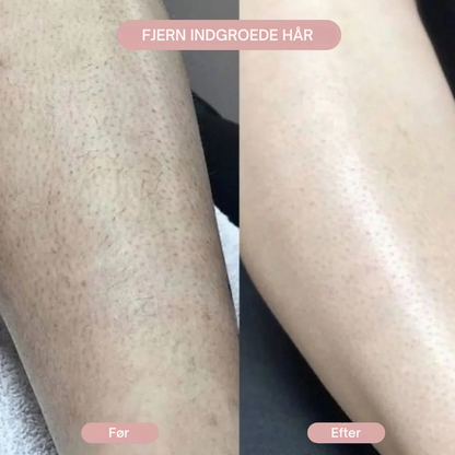 SilkPro™ - 2-i-1 Barbermaskine til Kvinder