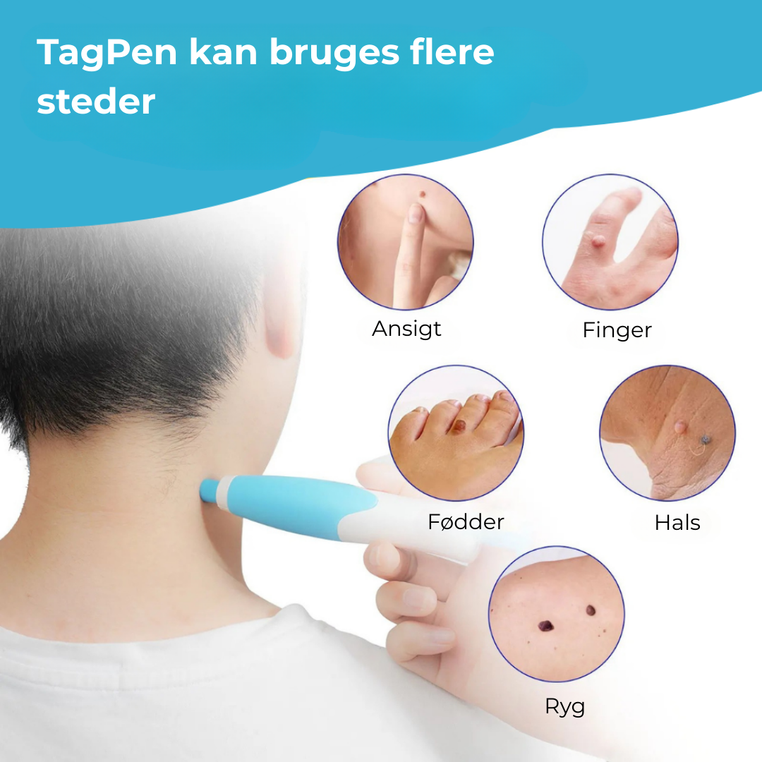 ClearSkin™ Pen – Sikker fjernelse af hudmærker!