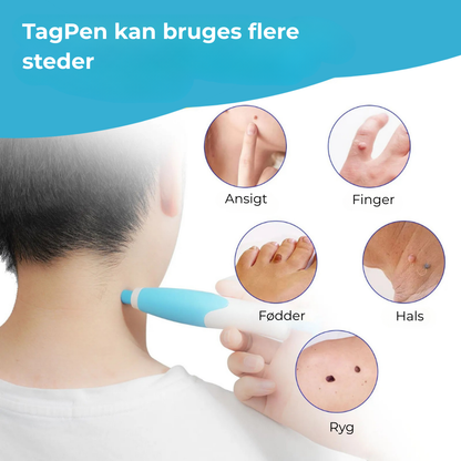 ClearSkin™ Pen – Sikker fjernelse af hudmærker!