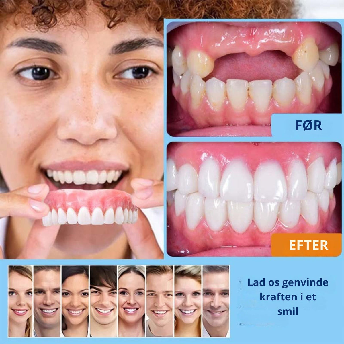 SmileForm™-🦷 Avancerede helproteser (begrænset tilbud ⏰)