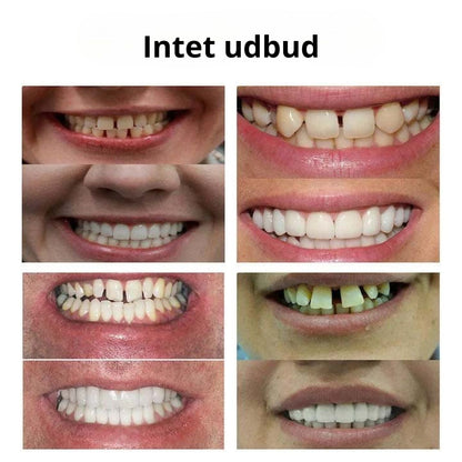 SmileForm™-🦷 Avancerede helproteser (begrænset tilbud ⏰)