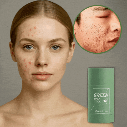 GreenLuxe™ | Fjern hudorme og urenheder på kun 10 minutter!